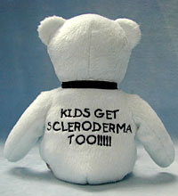 Scleroderma